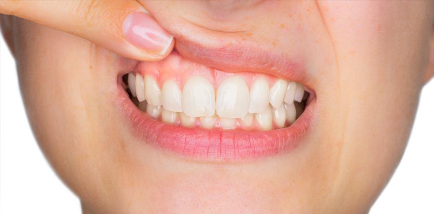 gum disease